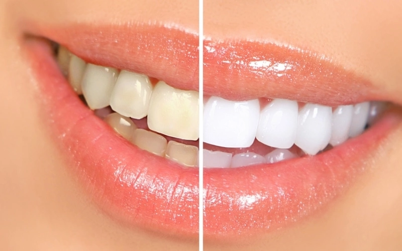 polski dentysta londyn ealing